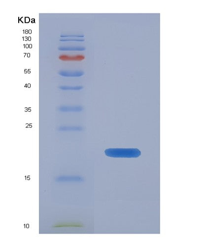 SDS-PAGE analysis of Mouse Fgf21 (Fibroblast Growth Factor 21) - Recombinant Protein, showing >90% purity under 15% SDS-PAGE (Reduced)
