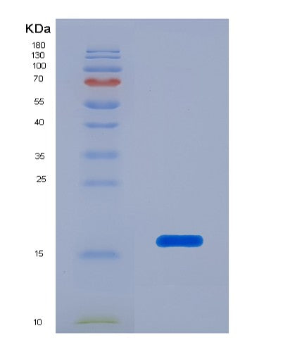 SDS-PAGE analysis of Human FNDC5 (Fibronectin Type Iii Domain-Containing Protein 5) - Recombinant Protein, showing >90% purity under 15% SDS-PAGE (Reduced)