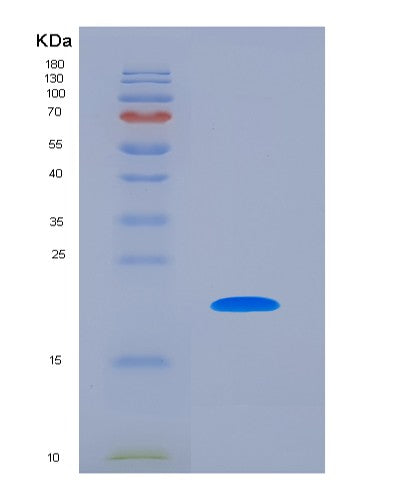 SDS-PAGE analysis of Human ACP3 (Prostatic Acid Phosphatase) - Recombinant Protein, showing >90% purity under 15% SDS-PAGE (Reduced)