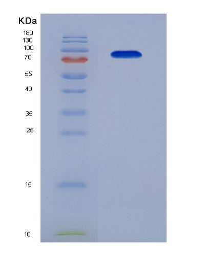 SDS-PAGE analysis of Human PLG (Plasminogen) - Recombinant Protein, showing >90% purity under 15% SDS-PAGE (Reduced)