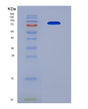 SDS-PAGE analysis of Human PLG (Plasminogen) - Recombinant Protein, showing >90% purity under 15% SDS-PAGE (Reduced)
