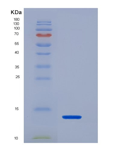 SDS-PAGE analysis of Human HNRNPA2B1 (Heterogeneous Nuclear Ribonucleoproteins A2/B1) - Recombinant Protein, showing >90% purity under 15% SDS-PAGE (Reduced)