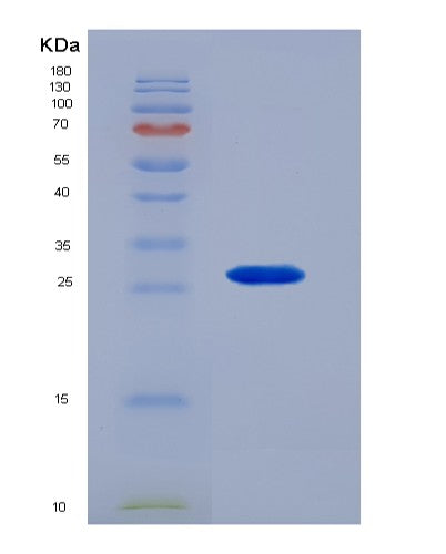SDS-PAGE analysis of Human KLK4 (Kallikrein-4) - Recombinant Protein, showing >90% purity under 15% SDS-PAGE (Reduced)