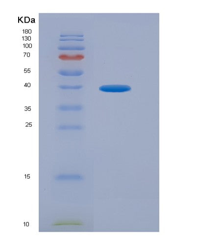 SDS-PAGE analysis of Human CD200R1 (Cell Surface Glycoprotein Cd200 Receptor 1) - Recombinant Protein, showing >90% purity under 15% SDS-PAGE (Reduced)