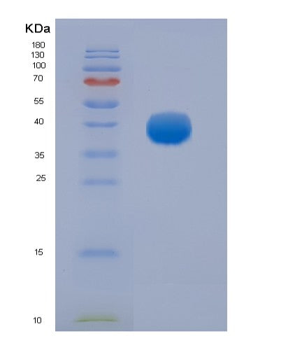 SDS-PAGE analysis of Human FCGR3A (Low Affinity Immunoglobulin Gamma Fc Region Receptor Iii-A) - Recombinant Protein, showing >90% purity under 15% SDS-PAGE (Reduced)