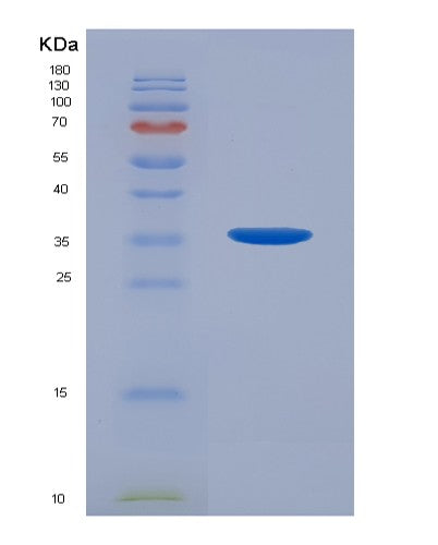 SDS-PAGE analysis of Human AR (Androgen Receptor) - Recombinant Protein, showing >90% purity under 15% SDS-PAGE (Reduced)