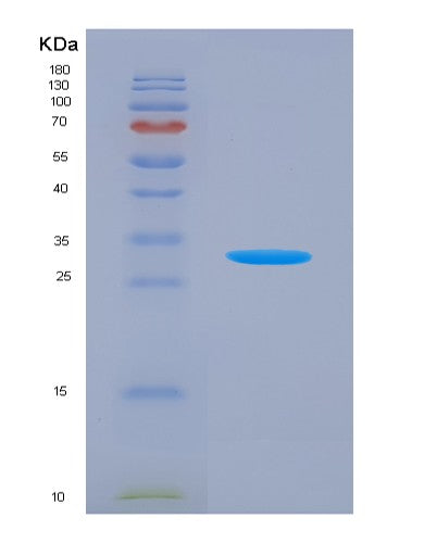 SDS-PAGE analysis of Human NLRP3 (Nacht, Lrr And Pyd Domains-Containing Protein 3) - Recombinant Protein, showing >90% purity under 15% SDS-PAGE (Reduced)
