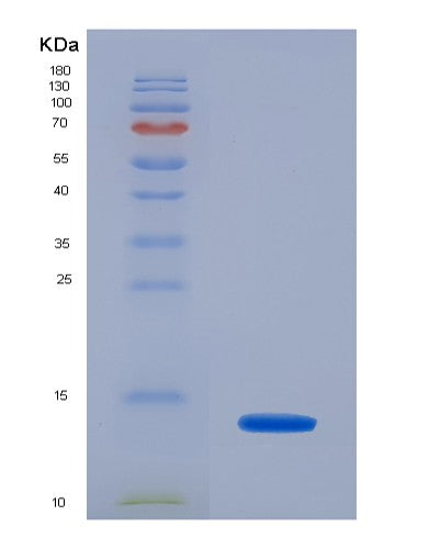 SDS-PAGE analysis of Human AMH (Muellerian-Inhibiting Factor) - Recombinant Protein, showing >90% purity under 15% SDS-PAGE (Reduced)
