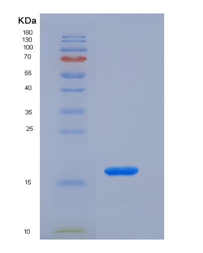 SDS-PAGE analysis of Human CCL2 (C-C Motif Chemokine 2) - Recombinant Protein, showing >90% purity under 15% SDS-PAGE (Reduced)