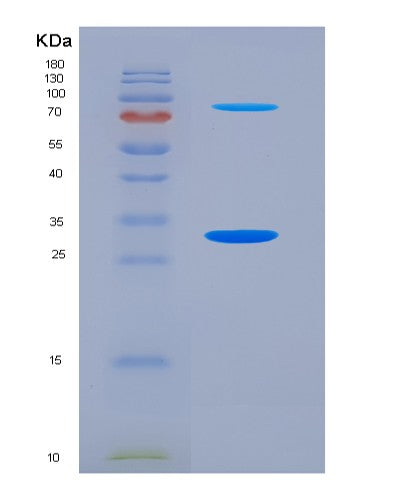 SDS-PAGE analysis of Human COL12A1 (Collagen Alpha-1(Xii) Chain) - Recombinant Protein, showing >90% purity under 15% SDS-PAGE (Reduced)
