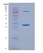 SDS-PAGE analysis of Human COL12A1 (Collagen Alpha-1(Xii) Chain) - Recombinant Protein, showing >90% purity under 15% SDS-PAGE (Reduced)