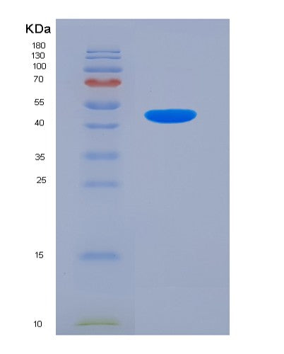SDS-PAGE analysis of Mouse Penk (Proenkephalin-A) - Recombinant Protein, showing >90% purity under 15% SDS-PAGE (Reduced)