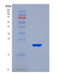 SDS-PAGE analysis of Human SLC5A1 (Sodium/Glucose Cotransporter 1) - Recombinant Protein, showing >90% purity under 15% SDS-PAGE (Reduced)
