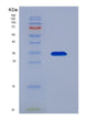 SDS-PAGE analysis of Mouse C4b (Complement C4-B) - Recombinant Protein, showing >90% purity under 15% SDS-PAGE (Reduced)