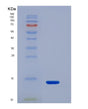 SDS-PAGE analysis of Human CAP1 (Adenylyl Cyclase-Associated Protein 1) - Recombinant Protein, showing >90% purity under 15% SDS-PAGE (Reduced)