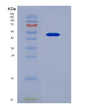 SDS-PAGE analysis of Human CHRNA7 (Neuronal Acetylcholine Receptor Subunit Alpha-7) - Recombinant Protein, showing >90% purity under 15% SDS-PAGE (Reduced)
