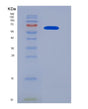 SDS-PAGE analysis of Human CAT (Catalase) - Recombinant Protein, showing >90% purity under 15% SDS-PAGE (Reduced)