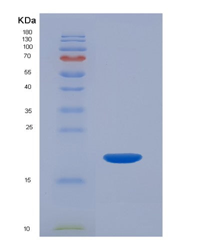 SDS-PAGE analysis of Human MAP1LC3B2 (Microtubule-Associated Protein 1 Light Chain 3 Beta 2) - Recombinant Protein, showing >95% purity under 15% SDS-PAGE (Reduced)
