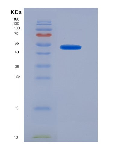 SDS-PAGE analysis of Human NR1H4 (Bile Acid Receptor) - Recombinant Protein, showing >90% purity under 15% SDS-PAGE (Reduced)