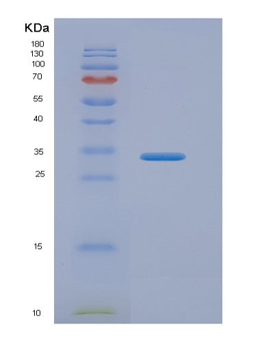 SDS-PAGE analysis of Human ASPA (Aspartoacylase) - Recombinant Protein, showing >95% purity under 15% SDS-PAGE (Reduced)