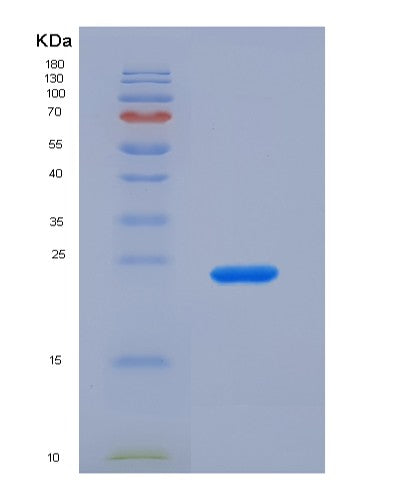SDS-PAGE analysis of Human CRYAB (Alpha-Crystallin B Chain) - Recombinant Protein, showing >90% purity under 15% SDS-PAGE (Reduced)