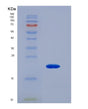 SDS-PAGE analysis of Human Vitamin D Receptor (VDR) - Recombinant Protein, showing >90% purity under 15% SDS-PAGE (Reduced)