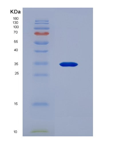 SDS-PAGE analysis of Human Thymopoietin (TMPO) - Recombinant Protein, showing >90% purity under 15% SDS-PAGE (Reduced)