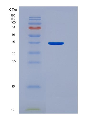 SDS-PAGE analysis of Human PDLIM1 (Pdz And Lim Domain Protein 1) - Recombinant Protein, showing >85% purity under 15% SDS-PAGE (Reduced)