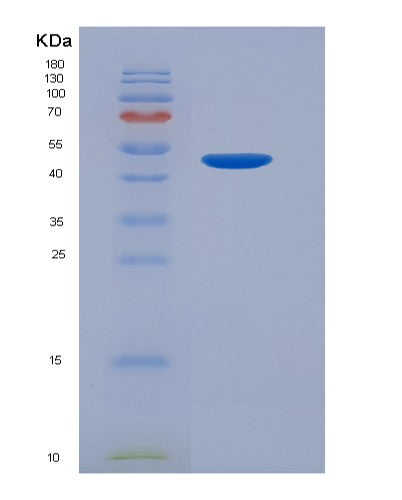 SDS-PAGE analysis of Human LGALS9 (Galectin-9) - Recombinant Protein, showing >90% purity under 15% SDS-PAGE (Reduced)
