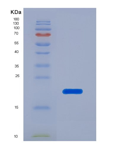 SDS-PAGE analysis of Human Toll Like Receptor 7 (TLR7) - Recombinant Protein, showing >90% purity under 15% SDS-PAGE (Reduced)