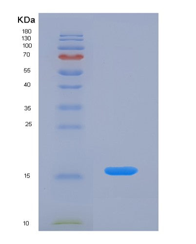 SDS-PAGE analysis of Human AGRP (Agouti-Related Protein) - Recombinant Protein, showing >95% purity under 15% SDS-PAGE (Reduced)