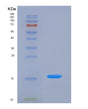 SDS-PAGE analysis of Human AGRP (Agouti-Related Protein) - Recombinant Protein, showing >95% purity under 15% SDS-PAGE (Reduced)