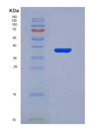 SDS-PAGE analysis of Human EEF2K (Eukaryotic Elongation Factor 2 Kinase) - Recombinant Protein, showing >90% purity under 15% SDS-PAGE (Reduced)