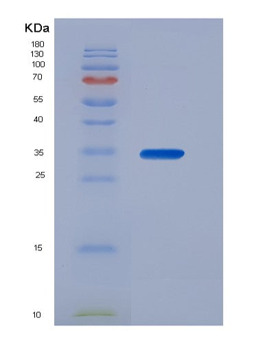 SDS-PAGE analysis of Human BIN1 (Myc Box-Dependent-Interacting Protein 1) - Recombinant Protein, showing >85% purity under 15% SDS-PAGE (Reduced)