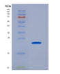 SDS-PAGE analysis of Mouse Tlr7 (Toll-Like Receptor 7) - Recombinant Protein, showing >90% purity under 15% SDS-PAGE (Reduced)