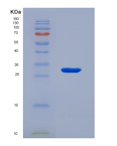 SDS-PAGE analysis of Human VWA1 (Von Willebrand Factor A Domain-Containing Protein 1) - Recombinant Protein, showing >90% purity under 15% SDS-PAGE (Reduced)