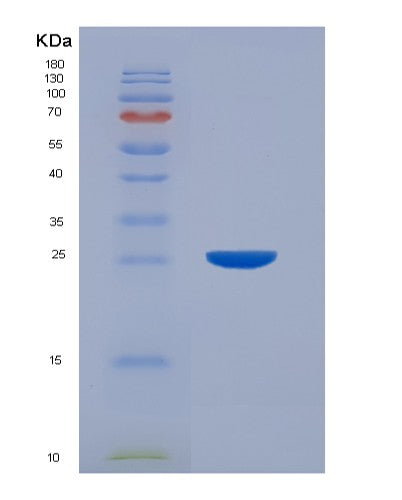 SDS-PAGE analysis of Human FBP2 (Fructose-1,6-Bisphosphatase Isozyme 2) - Recombinant Protein, showing >95% purity under 15% SDS-PAGE (Reduced)