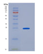 SDS-PAGE analysis of Human UBE2C (Ubiquitin-Conjugating Enzyme E2 C) - Recombinant Protein, showing >95% purity under 15% SDS-PAGE (Reduced)