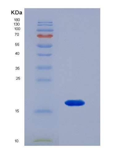 SDS-PAGE analysis of Human SPRR1A (Cornifin-A) - Recombinant Protein, showing >90% purity under 15% SDS-PAGE (Reduced)