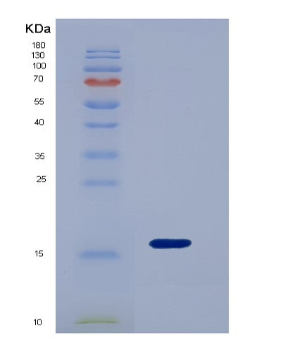 SDS-PAGE analysis of Mouse Lgals9 (Galectin-9) - Recombinant Protein, showing >90% purity under 15% SDS-PAGE (Reduced)
