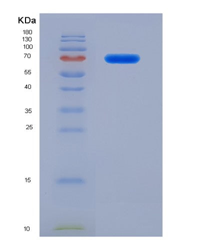 SDS-PAGE analysis of Human COL3A1 (Collagen Alpha-1(Iii) Chain) - Recombinant Protein, showing >90% purity under 15% SDS-PAGE (Reduced)
