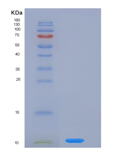 SDS-PAGE analysis of Mouse Nrg4 (Pro-Neuregulin-4, Membrane-Bound Isoform) - Recombinant Protein, showing >90% purity under 15% SDS-PAGE (Reduced)