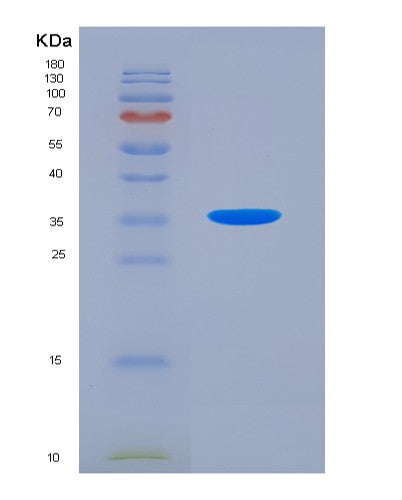 SDS-PAGE analysis of Human MTOR (Serine/Threonine-Protein Kinase Mtor) - Recombinant Protein, showing >90% purity under 15% SDS-PAGE (Reduced)