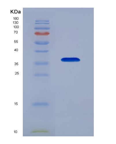 SDS-PAGE analysis of Human TOR1A (Torsin-1A) - Recombinant Protein, showing >90% purity under 15% SDS-PAGE (Reduced)