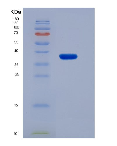 SDS-PAGE analysis of Human TPP1 (Tripeptidyl-Peptidase 1) - Recombinant Protein, showing >90% purity under 15% SDS-PAGE (Reduced)