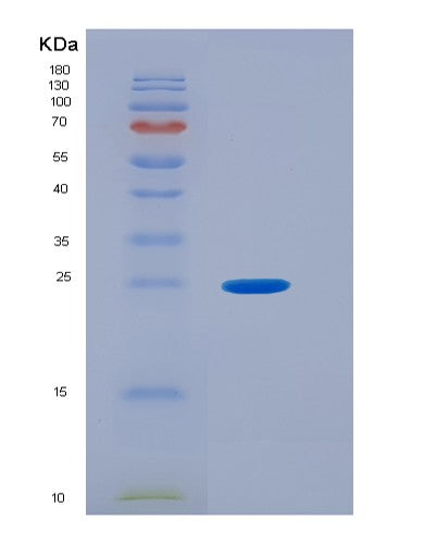 SDS-PAGE analysis of Human UBD (Ubiquitin D) - Recombinant Protein, showing >95% purity under 15% SDS-PAGE (Reduced)