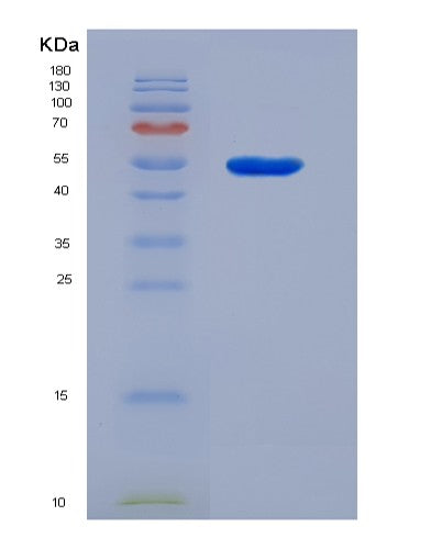 SDS-PAGE analysis of Human GFAP (Glial Fibrillary Acidic Protein) - Recombinant Protein, showing >90% purity under 15% SDS-PAGE (Reduced)