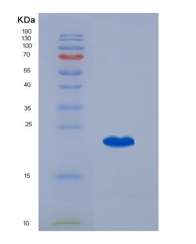SDS-PAGE analysis of Human CCL25 (C-C Motif Chemokine 25) - Recombinant Protein, showing >95% purity under 15% SDS-PAGE (Reduced)