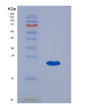 SDS-PAGE analysis of Human CCL25 (C-C Motif Chemokine 25) - Recombinant Protein, showing >95% purity under 15% SDS-PAGE (Reduced)