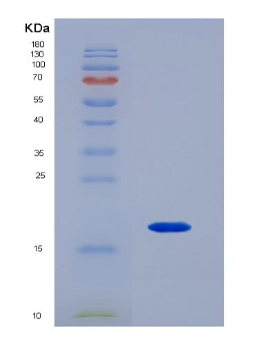 SDS-PAGE analysis of Mouse Sdc4 (Syndecan-4) - Recombinant Protein, showing >90% purity under 15% SDS-PAGE (Reduced)